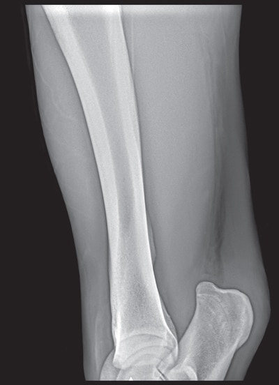 a leg xray.