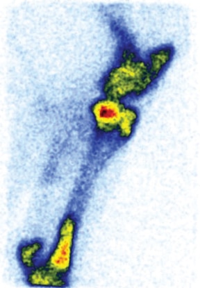 a scan of a leg.